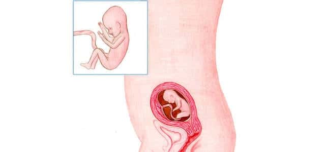 Pregnancy Week 17: Do not do Abdominal Exercises