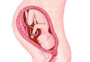 Pregnancy Week 36: Separation or amniotic fluid?