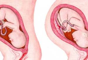 Pregnancy Week 37-41: Your baby may be born...!